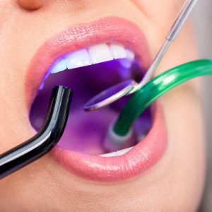 Dentist Procedure